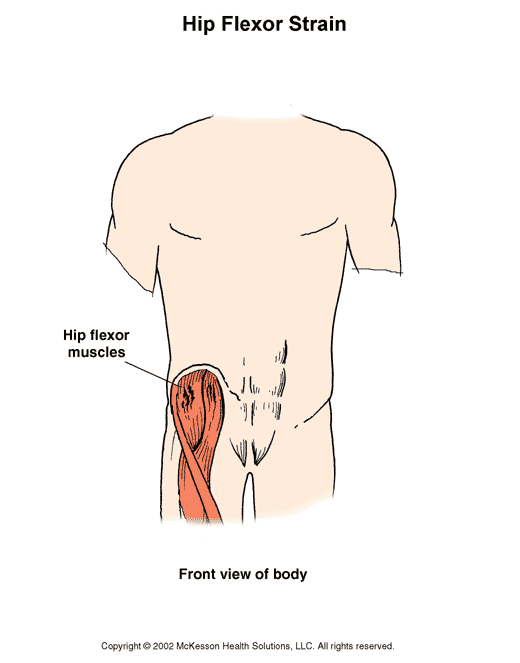 Hip Flexor Strain:  Illustration