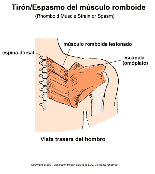 Tirn del msculo romboide: ilustracin