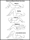 Thumbnail image of: Abdominal Muscle Strain Exercises:  Illustration