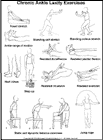 Thumbnail image of: Chronic Ankle Laxity Exercises:  Illustration