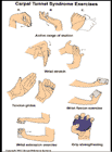 Thumbnail image of: Carpal Tunnel Syndrome Exercises:  Illustration