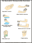 Thumbnail image of: De Quervain's Tenosynovitis Exercises: Illustration