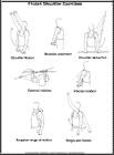 Thumbnail image of: Frozen Shoulder Exercises:  Illustration