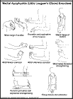 Thumbnail image of: Medial Apophysitis (Little Leaguer's Elbow) Exercises:  Illustration
