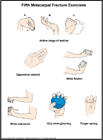 Thumbnail image of: Fifth Metacarpal Fracture Exercises: Illustration