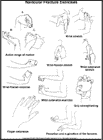 Thumbnail image of: Navicular (Scaphoid) Fracture Exercises:  Illustration