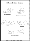 Thumbnail image of: Piriformis Syndrome Exercises:  Illustration