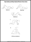 Thumbnail image of: Spondylolysis and Spondylolisthesis Exercises:  Illustration