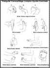Thumbnail image of: Triangular Fibrocartilage Complex Injuries Exercises:  Illustration