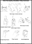Thumbnail image of: Ulnar Neuropathy (Handlebar Palsy) Exercises:  Illustration