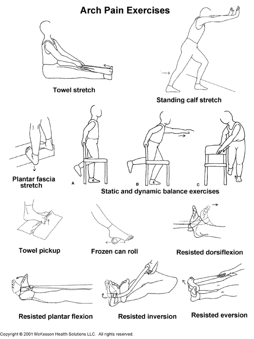 Arch Pain Exercises:  Illustration