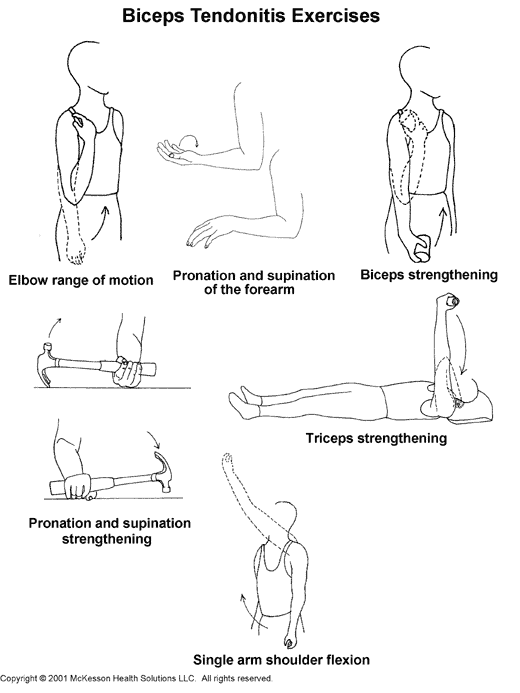Biceps Tendonitis Exercises:  Illustration