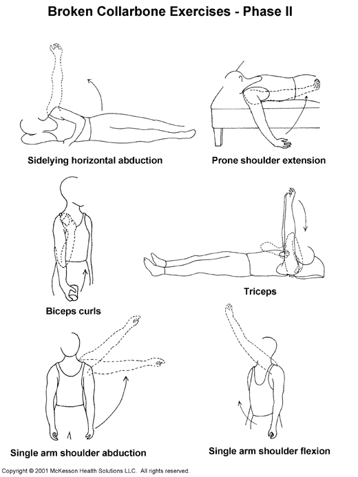 trama Madurar mil Sports Medicine Advisor 2003.1: Broken Collarbone Exercises, Phase II:  Illustration