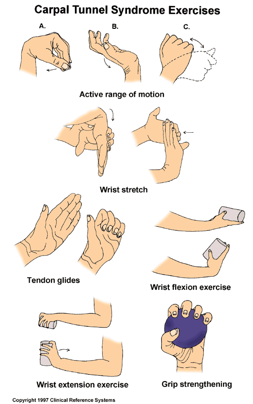 Carpal Tunnel Syndrome Exercises:  Illustration