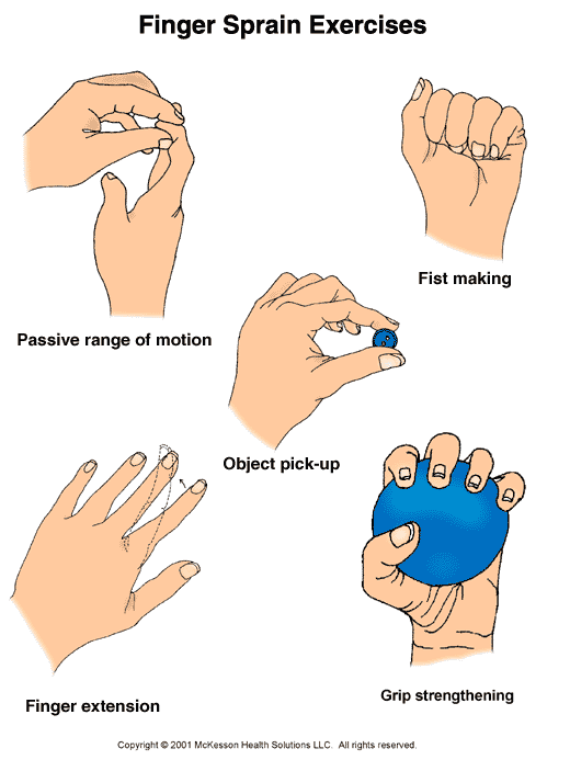 Finger Sprain Exercises:  Illustration