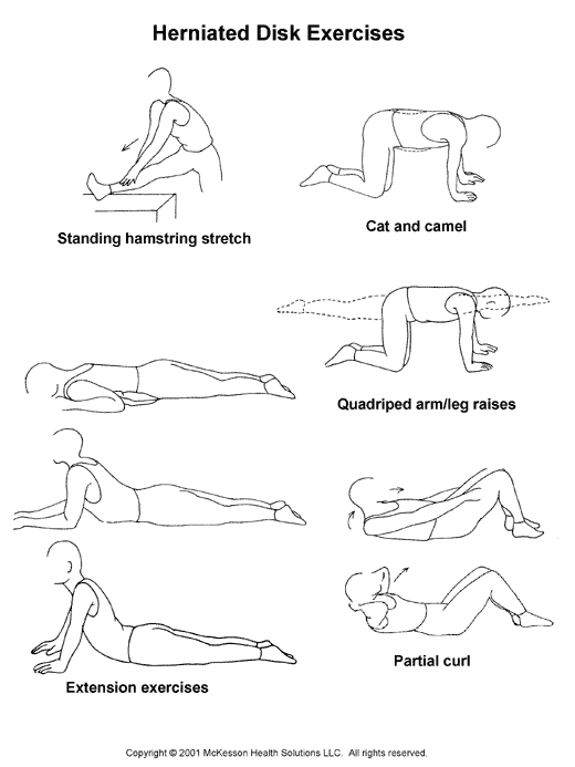 Herniated Disk Exercises:  Illustration