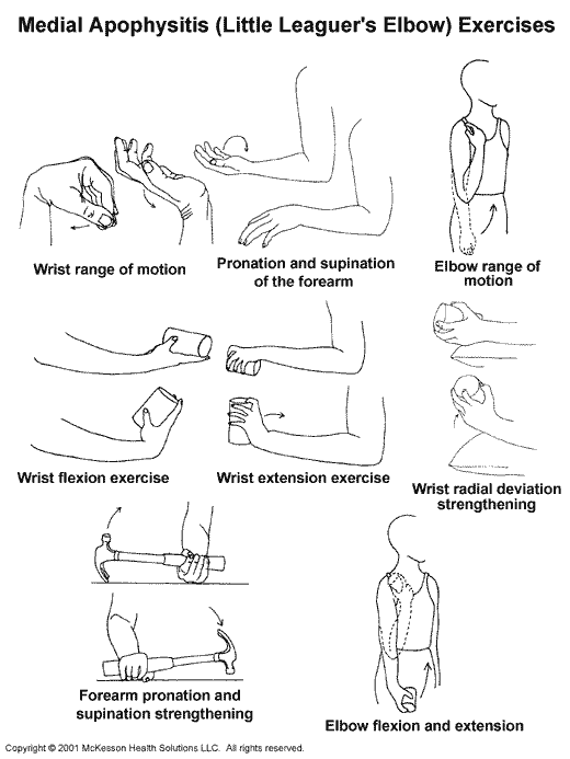 Medial Apophysitis (Little Leaguer's Elbow) Exercises:  Illustration