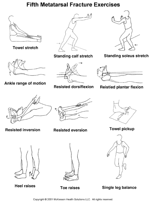 Fifth Metatarsal Fracture Exercises: Illustration