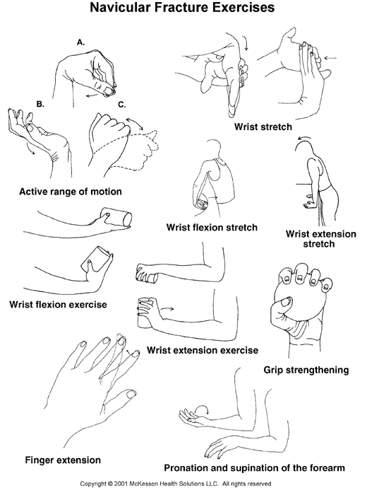 Navicular (Scaphoid) Fracture Exercises:  Illustration