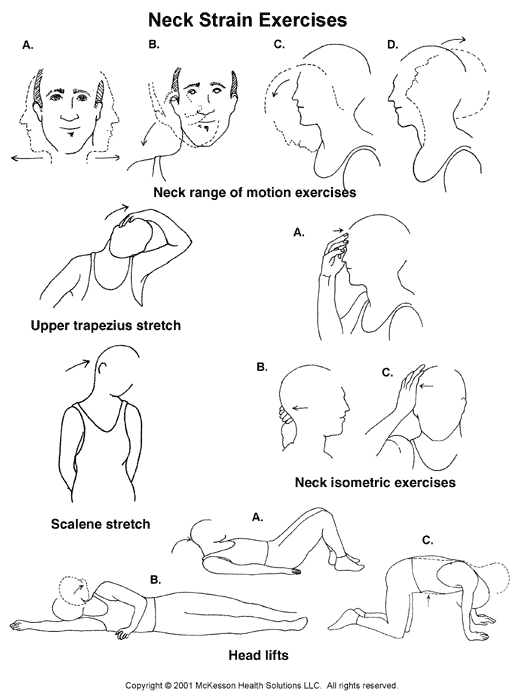 Neck Strain Exercises:  Illustration
