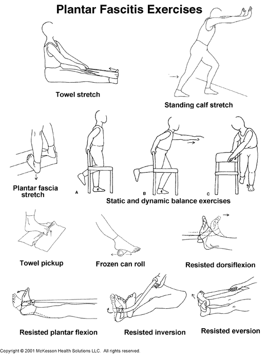 Sports Medicine Advisor 2003.1: Plantar Fasciitis Exercises: Illustration
