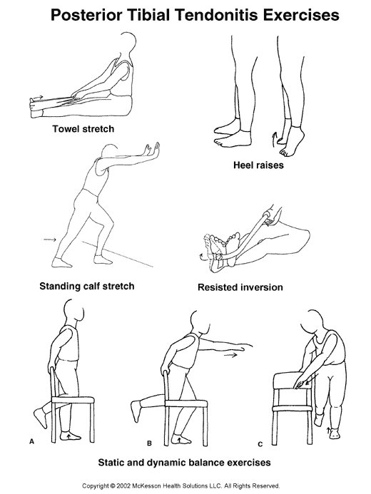Posterior Tibial Tendonitis Exercises:  Illustration