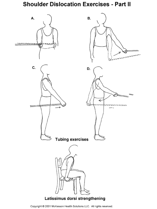 Dislocated Shoulder Exercises, Part II:  Illustration