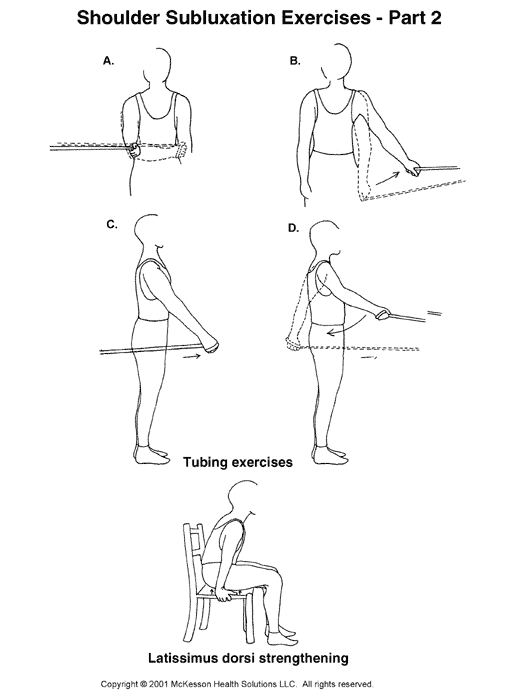 Shoulder Subluxation Exercises, Part II:  Illustration