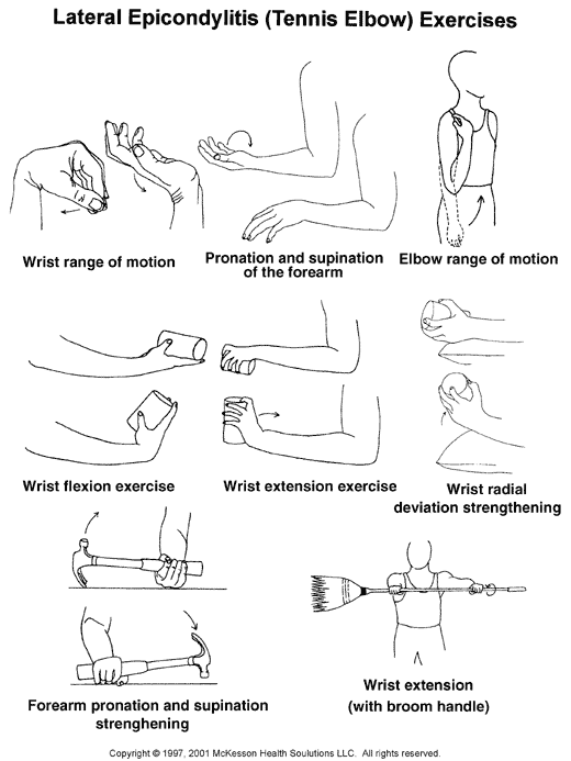 Lateral Epicondylitis (Tennis Elbow) Exercises: Illustration