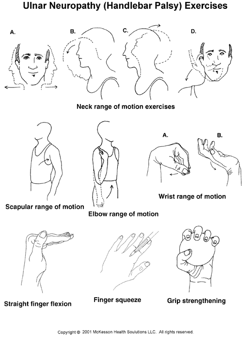Ulnar Neuropathy (Handlebar Palsy) Exercises:  Illustration