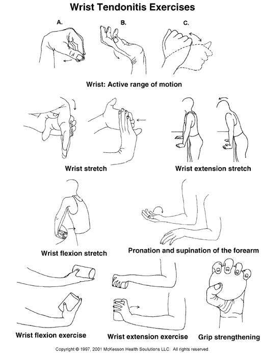 Wrist Tendonitis Exercises:  Illustration